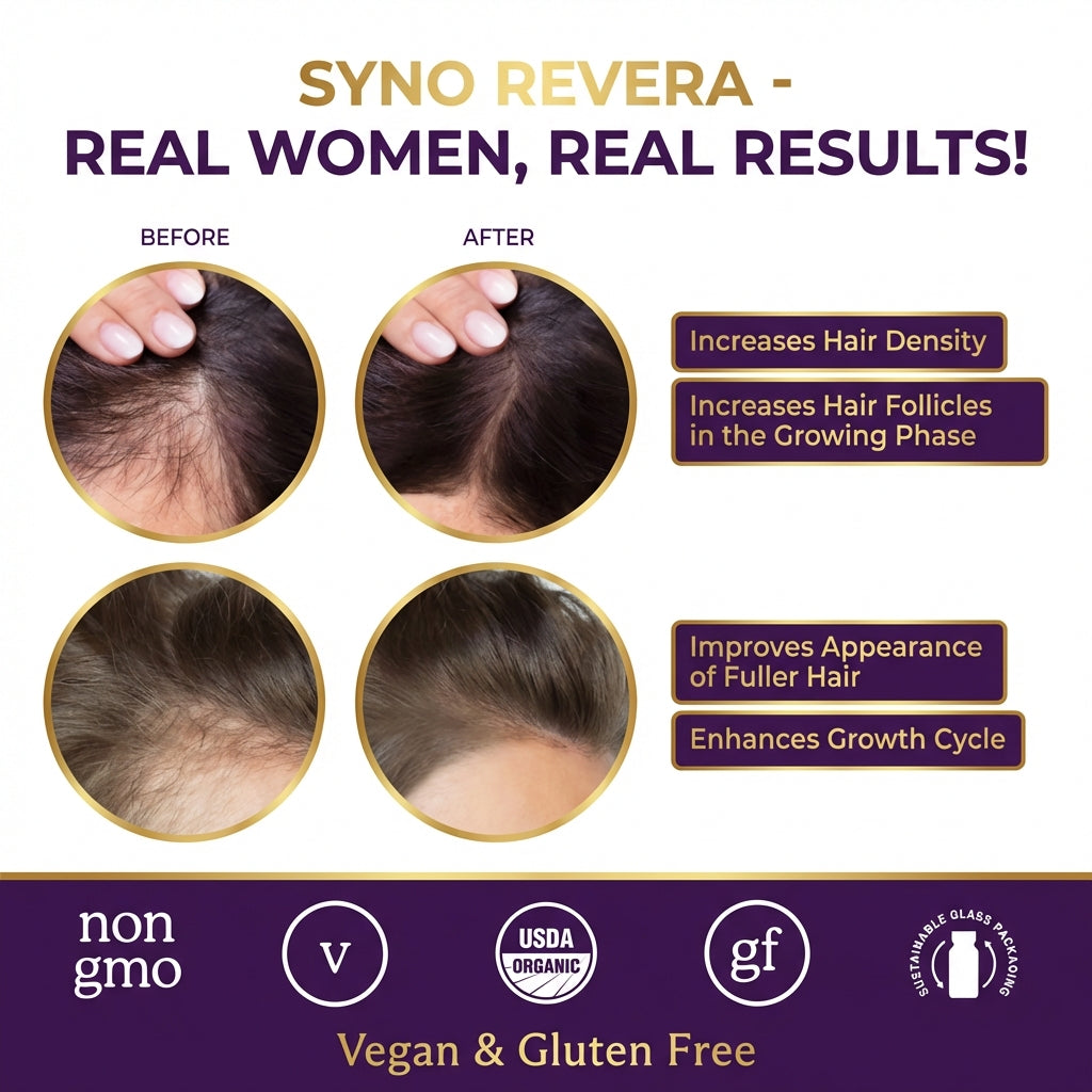 SYNO REVERA | DHT Inhibitor Formula for Hormonal Hair Loss | 1+1 FREE
